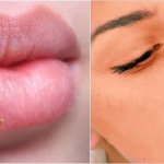 Причины появления и лечения прыща на губе